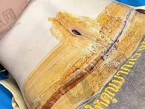 袁玉坤医生基本情况介绍