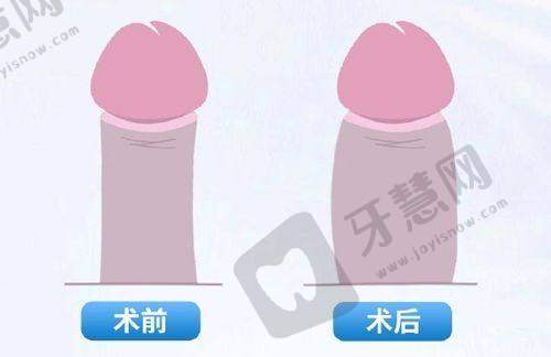 广州曙光华榜植发医院