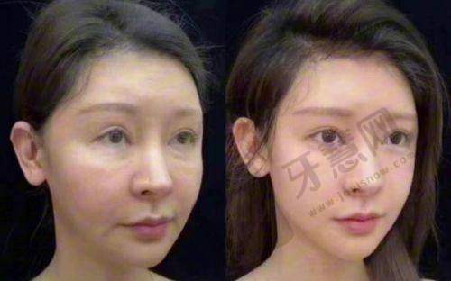 广州美莱医美医院地址电话及营业时间：