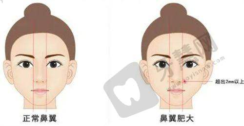 宁波珈禾整形成效感受