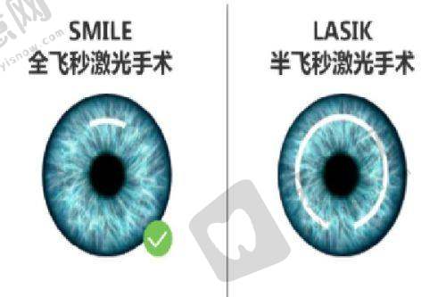 刘苏冰坐诊的郑州华厦视光咋样
