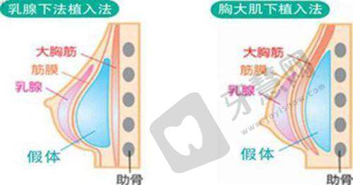 广州博仕整形医院口碑评价：