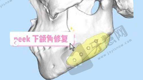 一、新客专属礼遇，西安叶子首届会员宠粉节超贴心