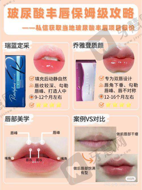 活动参与指南：如何较大化享受补贴