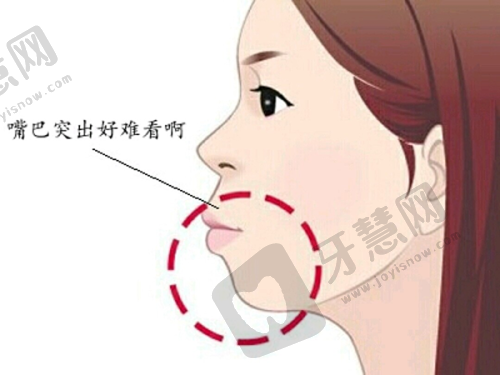 吕道玲医生擅长的抗衰项目