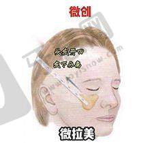 广州建国医院男科正规吗？