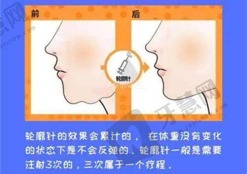 广州佳人医疗美容门诊部地址电话及营业时间：