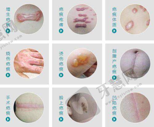 广州青逸植发医院预约挂号方式：