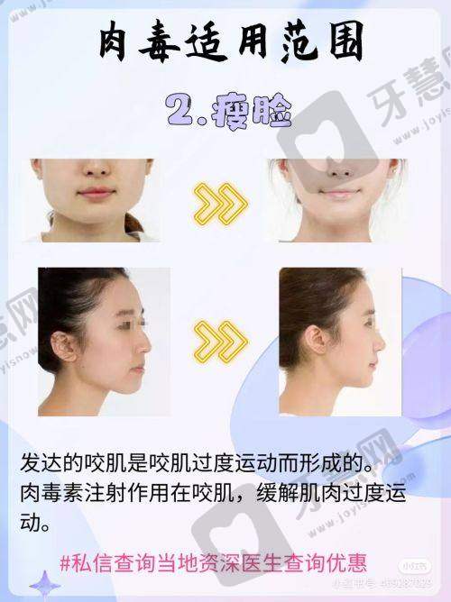 广东崇爱修复医院植发科预约挂号方式：