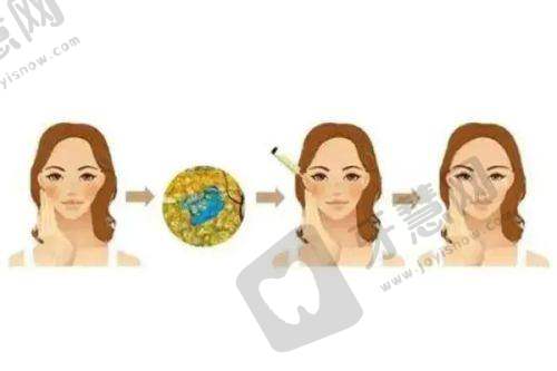广州美莱医美医院诊疗项目：