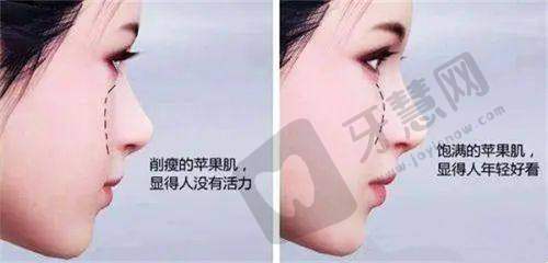 广东崇爱修复医院植发科地址电话及营业时间：