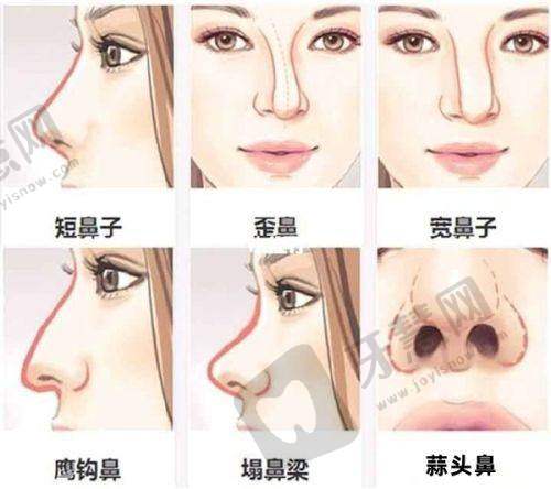 广州至简医疗美容门诊部正规吗？
