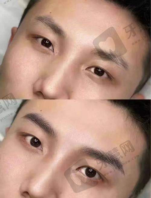 昆明杰西艾整形医院项目特色