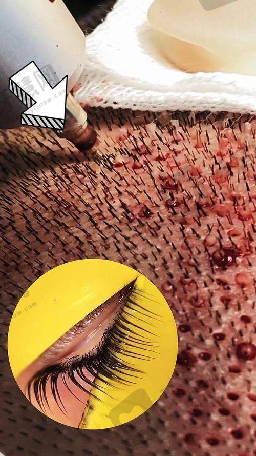 昆明源生植发医院怎么样，口碑评价如何？