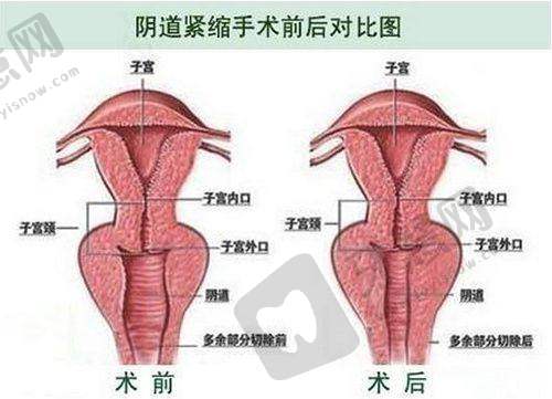 苏州美莱美容医院24小时问诊热线特色项目