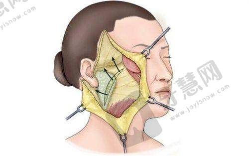 呼和浩特医美在线问诊电话24小时服务热线：在线咨询及美容医院推荐