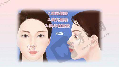 金华玥莱美医疗美容:精细化操作与高性价比之选