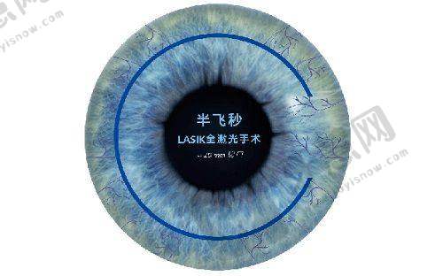 2025同仁眼科魏文斌电话预约挂号要注意什么?