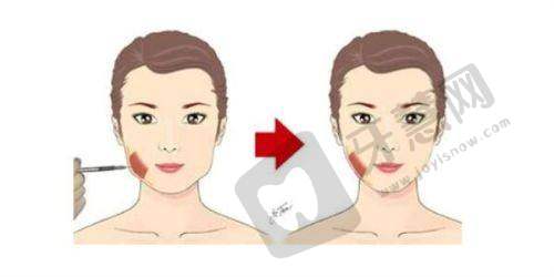 常州施尔美整形美容医院24小时服务特色