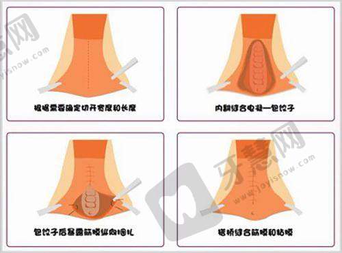 西宁正规整形医院top10之青海云熙医美之家整形
