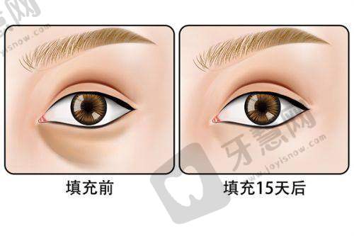 选择24小时医美热线服务的要点