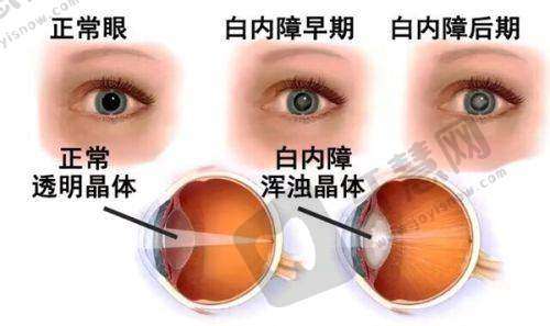 慈溪明康眼视光眼科医院是正规医院吗？