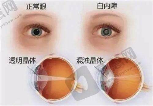 西安佰视佳眼科医院详细的预约挂号方式及流程