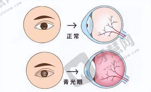 西安佰视佳眼科医院特色项目及技术优势