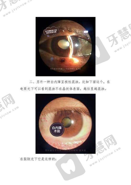 西安佰视佳眼科医院收费价格表/收费标准