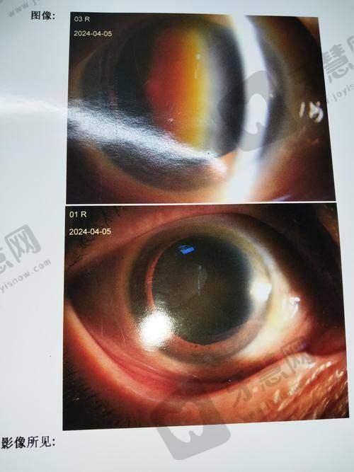 北京普祥眼科医院的价格情况详情