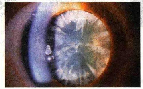 北京至亮眼科诊所(北太平庄.花园路旗舰店)特色优势