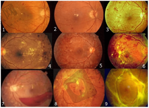 北京同仁医院眼科基本信息有哪些