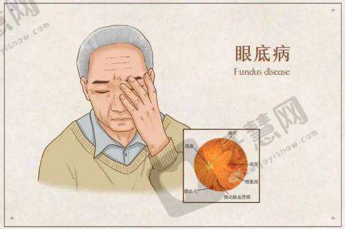 北京普祥眼科医院的擅长项目