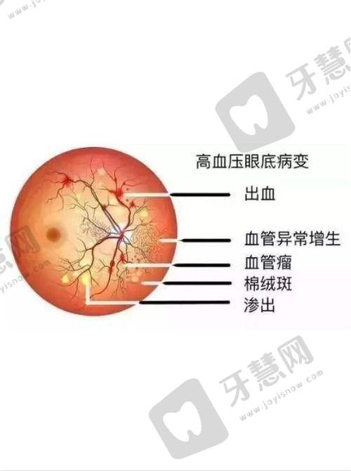 天津大学爱尔眼科医院收费价格表/收费标准