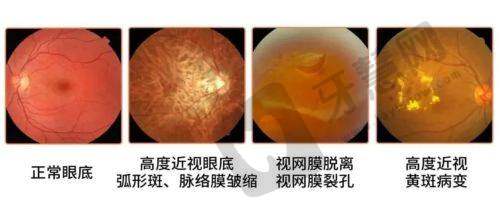 南昌爱尔眼科医院(江西总院)地址电话营业时间