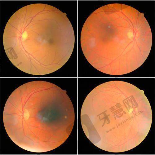 北京华厦民众眼科医院卢宁医生擅长项目有哪些