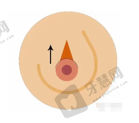 2025医美整形美容价格价目表：拉皮3万元起、隆胸1.68万起，磨骨2.5万起，认准加减美/圣嘉新/广大等正规医院！——磨骨手术价格及相关医院