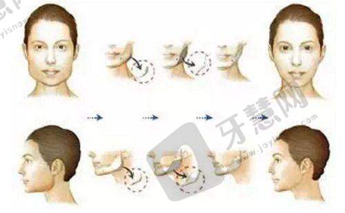 南京市第一医院眼科收费怎么样？其他检查与治疗项目收费情况