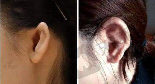 合肥双眼皮医院排名之合肥飞橙医疗美容