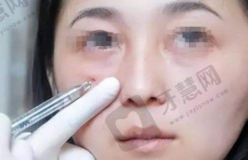 江苏省内口碑好的十大整形医院排名更新了!无锡地区优质整形机构