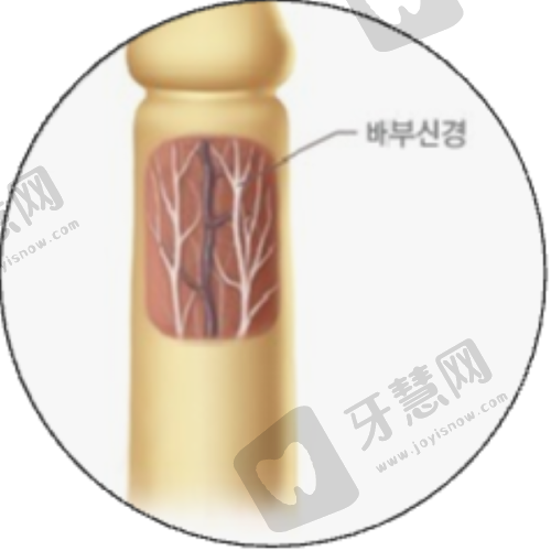 合肥双眼皮医院排名之合肥崔劲松整形医院