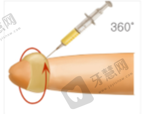 泰国四大变性手术医院排名展示——泰国咖蒙KAMOL整形美容医院