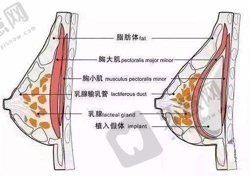 变性手术24小时免费在线问诊：操作指南