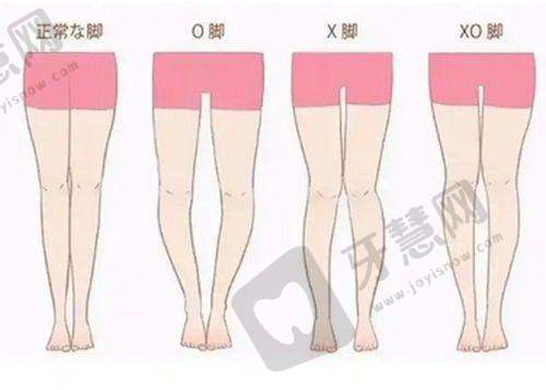 深圳博爱医院美容科隆胸收费