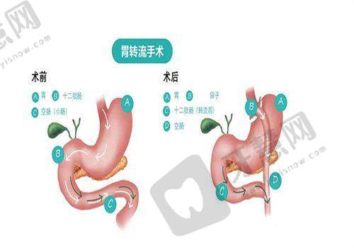 5. 种植牙询问必问清单：从费用到寿命一次聊透