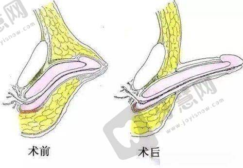 三、实测两家TOP医院热线:阿波罗vs九龙,服务差异在哪里?