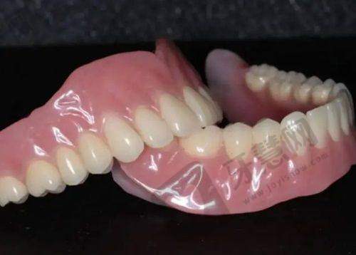 牙贴面多少钱一个:选择正规医院的重要性