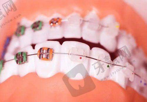 南京做烤瓷牙哪家好之其他值得关注医院