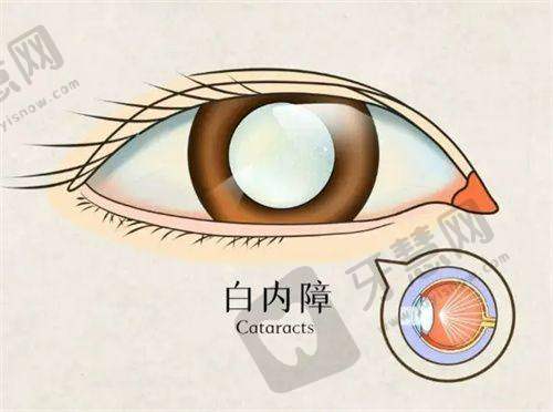 大连普兰店爱尔眼科医院与其他医院相比有哪些优势
