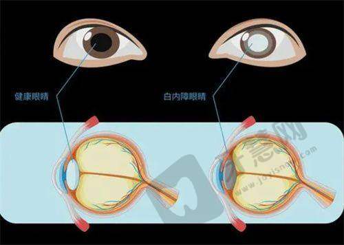北京熙仁医院眼科王乐今怎么挂号？线上多种方式助你约，还有出诊时间要记牢